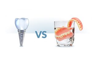 Dental implant and glass with a dental prosthesis