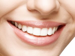 Smile with white healthy teeth