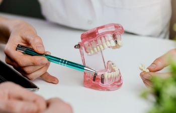 Dentist with a dental model explaining dental implant placement procedure.