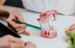 Dentist implantologist explaining dental implant restoration.
