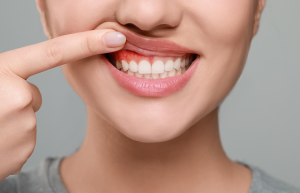 A person pulls back their upper lip, revealing red, inflamed gums above their teeth.